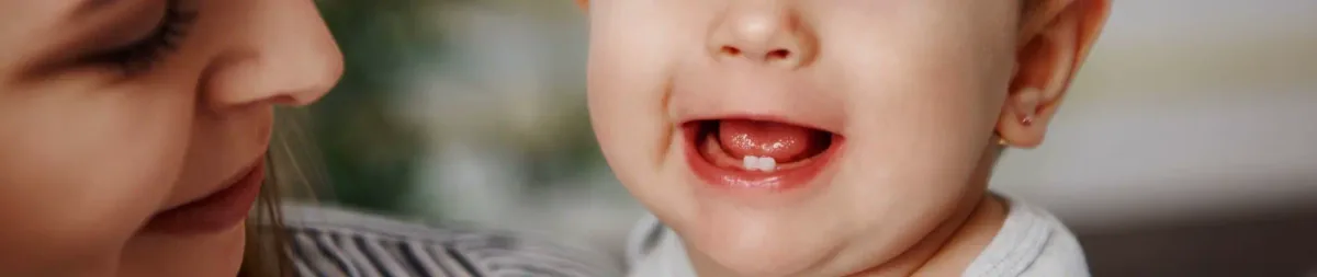 Крупный план первых зубов и дёсен малыша в период прорезывания, клиника Bite Squad Dental of NYC
